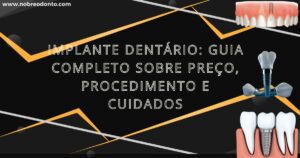 Implante Dentário: Guia Completo sobre Preço, Procedimento e Cuidados