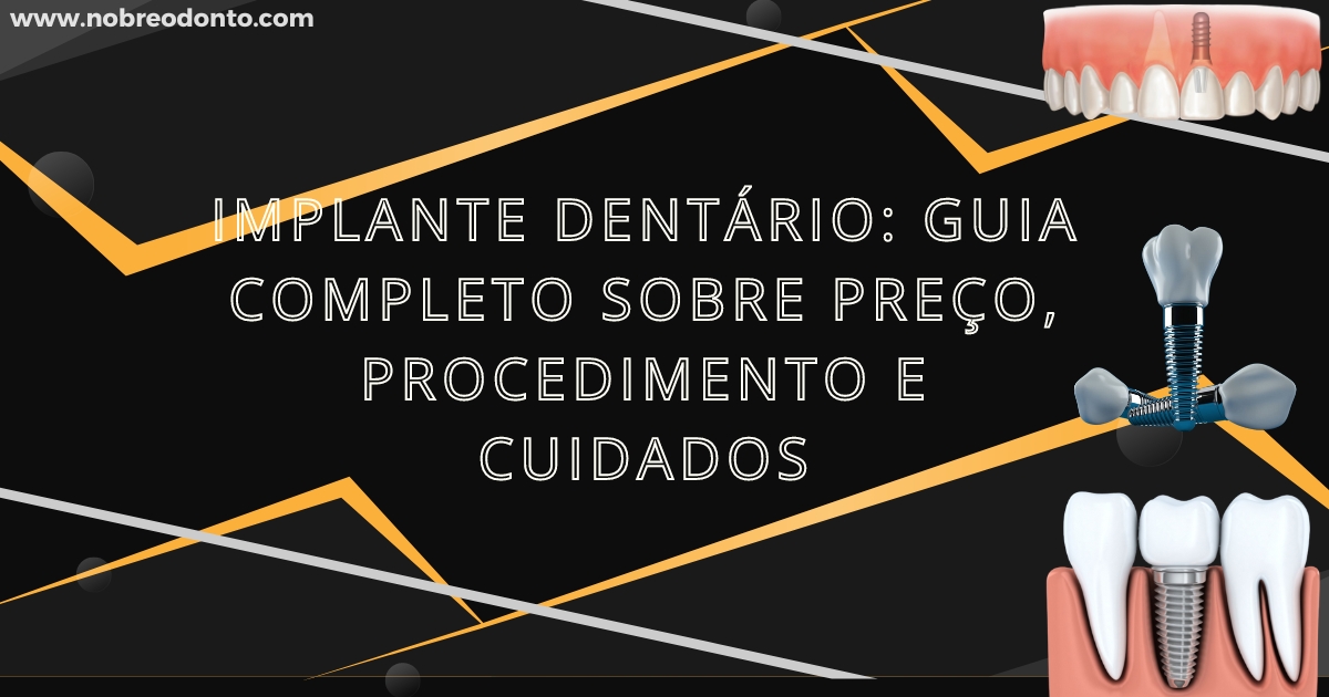 Imagem mostrando o procedimento de implante dentário unitário, com destaque para o processo de colocação do implante e o resultado final de um dente restaurado.