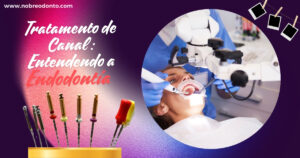 Endodontia: O Tratamento do Canal Radicular