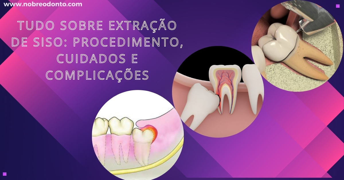 Três imagens ilustrando problemas comuns relacionados ao dente do siso: pericoronarite, reabsorção do dente vizinho e exodontia do siso.