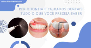 Periodontia e Cuidados Dentais: Tudo o que Você Precisa Saber